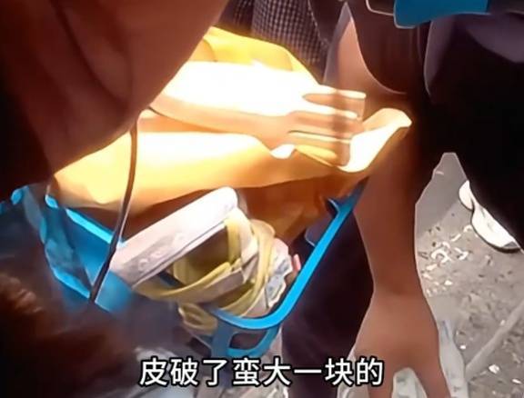 看著都疼<strong></p>
<p>西鳳酒
</strong>！上海街頭一男子突然求助：10歲女兒被死死卡??！這個行為太危險→:西鳳酒
