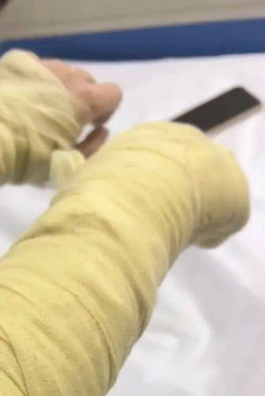 湖南一女主播被偽裝的包裹炸傷<strong></p>
<p>西鳳酒
</strong>，永州公安：正在核實具體情況:西鳳酒
