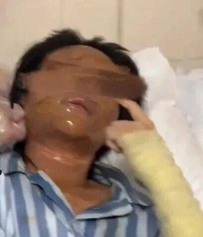 湖南一女主播被偽裝的包裹炸傷<strong></p>
<p>西鳳酒
</strong>，永州公安：正在核實具體情況:西鳳酒
