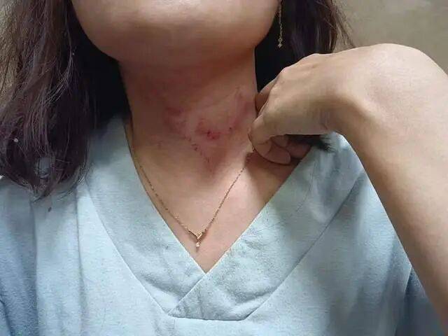 一男子凌晨聽到兩聲呼救<strong></p>
<p>西鳳酒
</strong>，循聲發(fā)現(xiàn)一女子在奔馳車外被白衣男勒昏！受害者：是受朋友之托借錢給白衣男，凌晨被騙至偏僻處遭非禮！:西鳳酒

