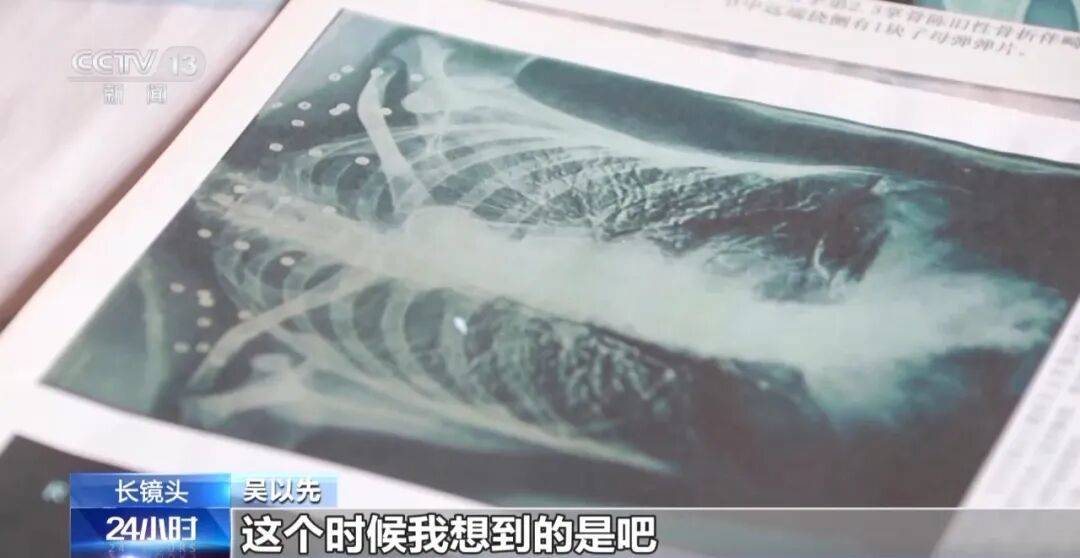 “老先生<strong></p>
<p>西鳳酒
</strong>，您把項(xiàng)鏈取下來(lái)再做CT”“你看是不是彈片”:西鳳酒
