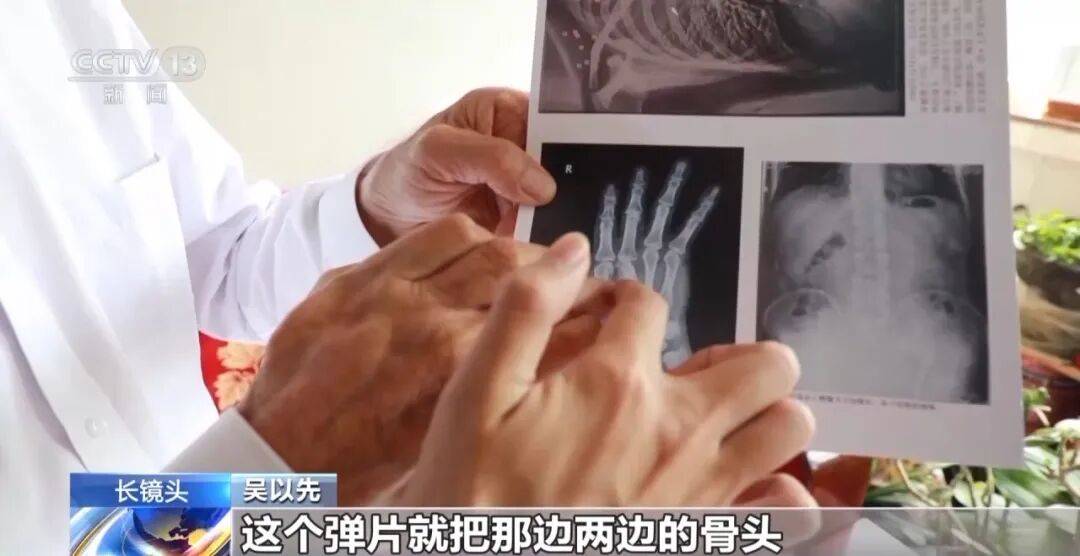 “老先生<strong></p>
<p>西鳳酒
</strong>，您把項(xiàng)鏈取下來(lái)再做CT”“你看是不是彈片”:西鳳酒
